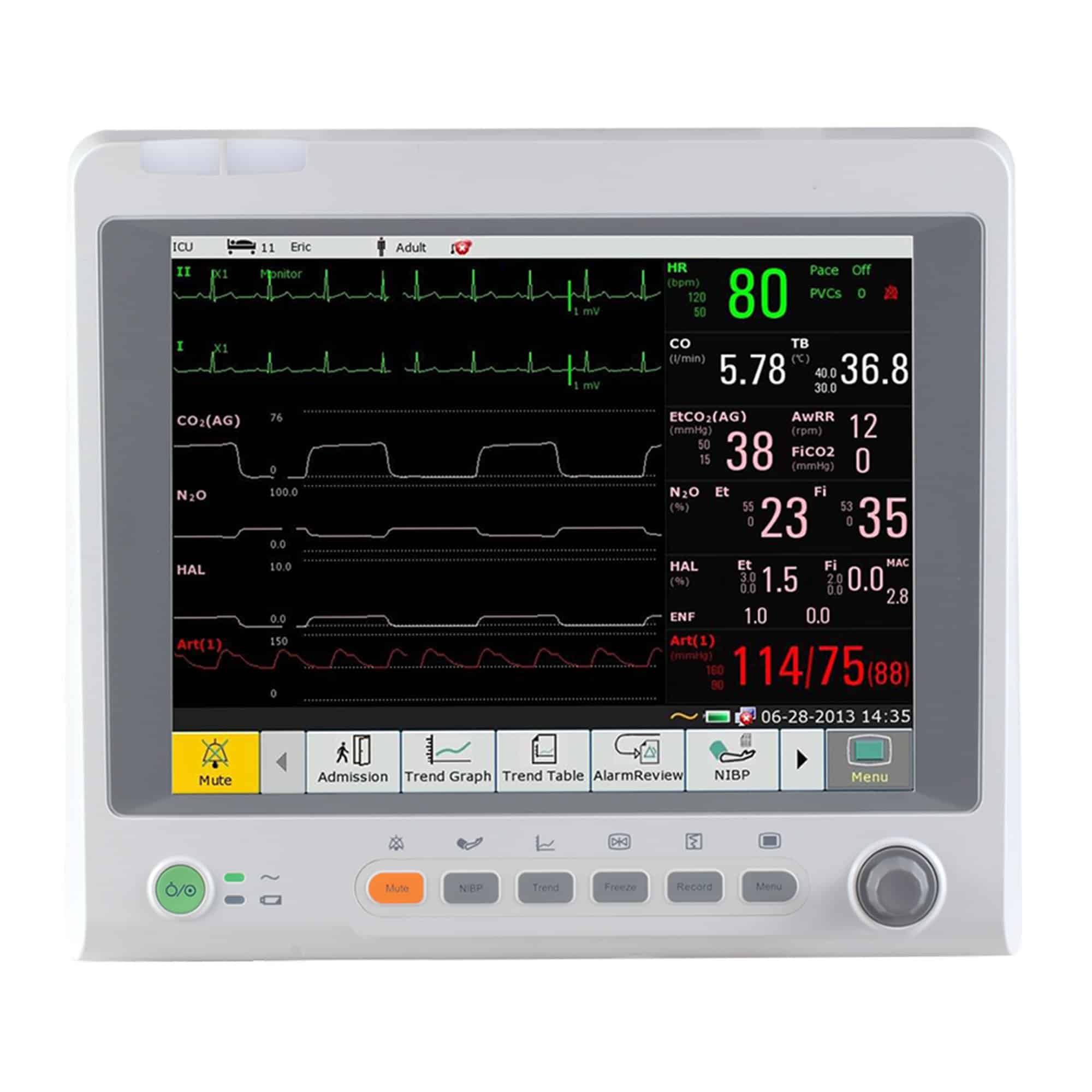Edan iM70 Patient Monitor with CO2 – New, Venture Medical Requip.