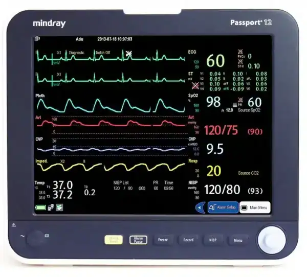 Anesthesia Monitor Module Mindray Passport 12 Anesthesia Monitor w/ AG Module - Venture Medical