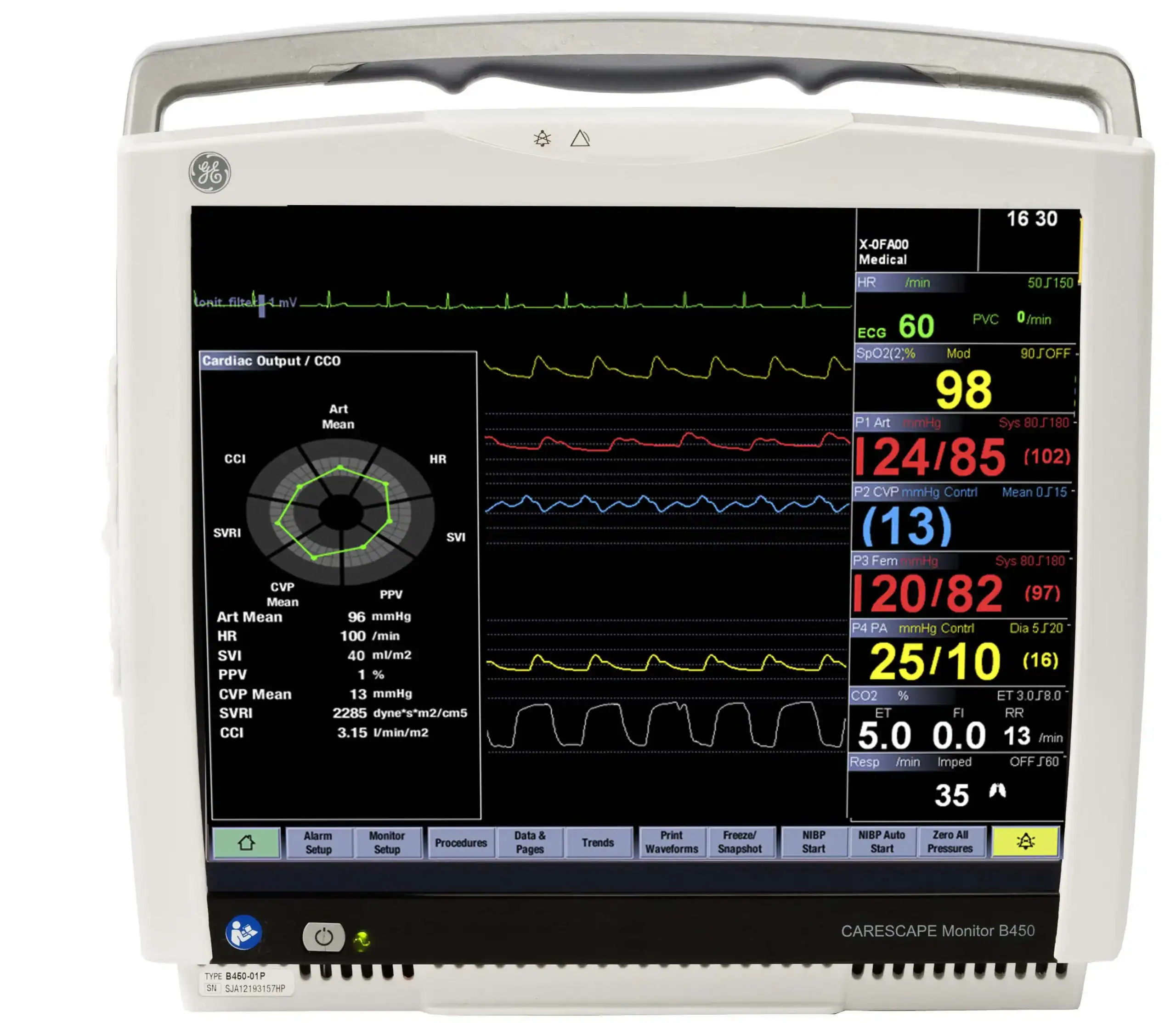 GE Carescape B450 Anesthesia Monitor – Refurbished, Venture Medical Requip.