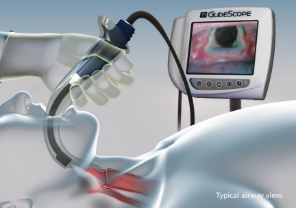 Verathon GlideScope AVL, Venture Medical Requip.